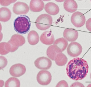 <p>Blood</p>