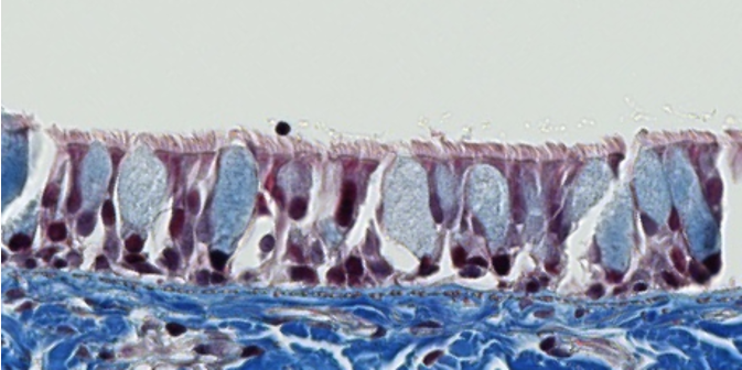 <p><span style="font-family: "Calibri Light";">Which type of cell surface modification does this epithelium have?</span></p>