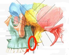 <p>Connects our medial pterygoid muscle.</p>