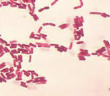 <p>Gram and morphology of this bacteria: pink to red stained bacteria with a rod-shaped morphology</p>