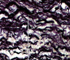 <p>What kind of tissue is being shown in the slide</p>