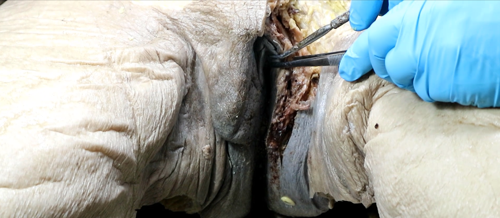 <p>(underneath clitoris)</p>