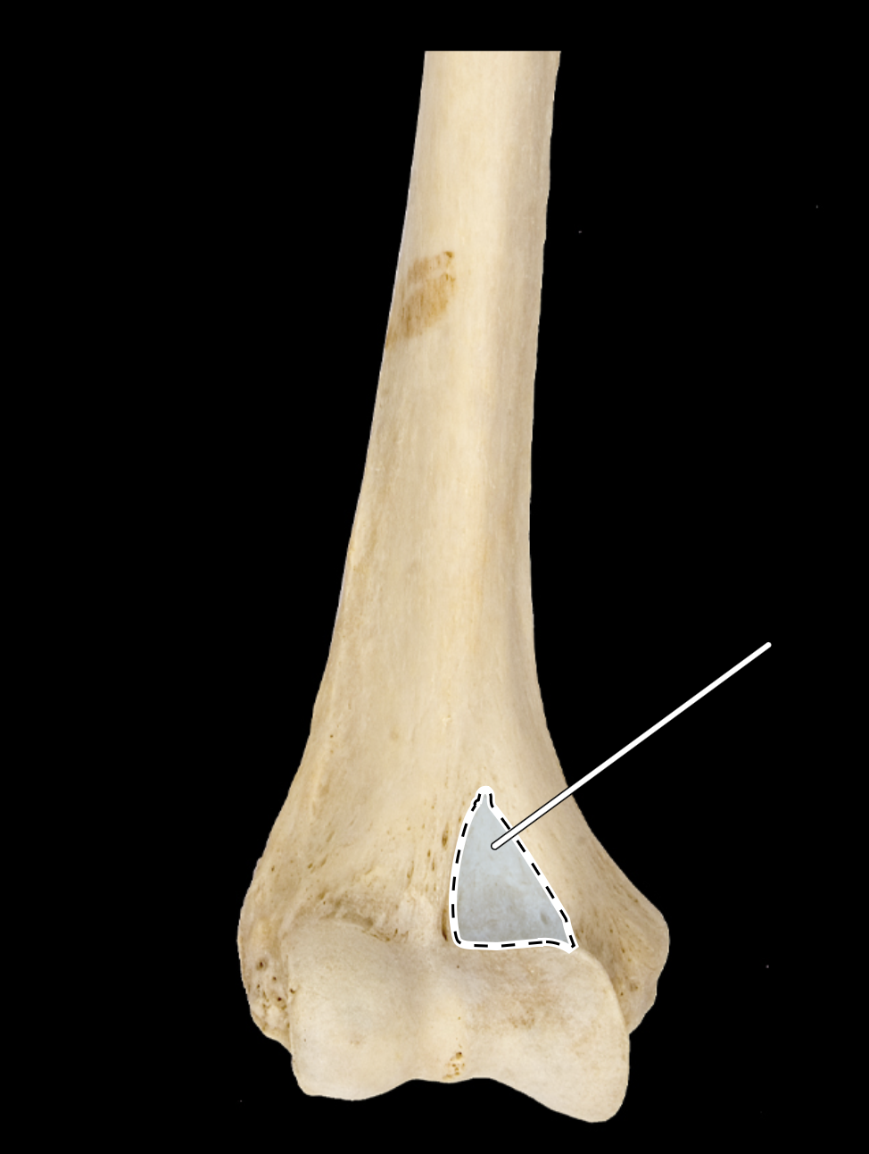 <p>anterior view</p>