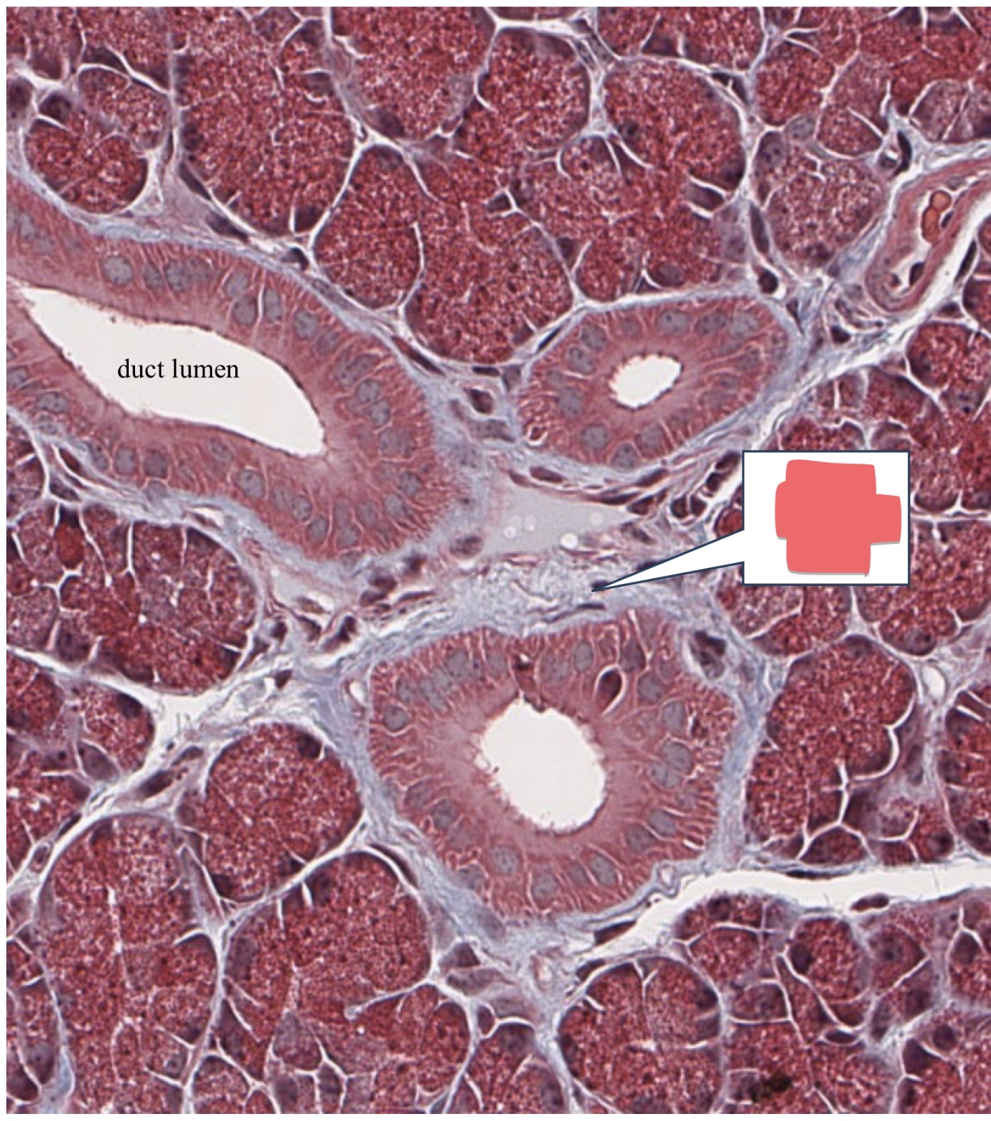term image
