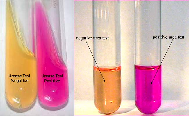 <ul><li><p>Detects urease, which breaks down urea into ammonia and CO<sub>2</sub></p></li><li><p>Positive: pink agar </p></li></ul><p></p>