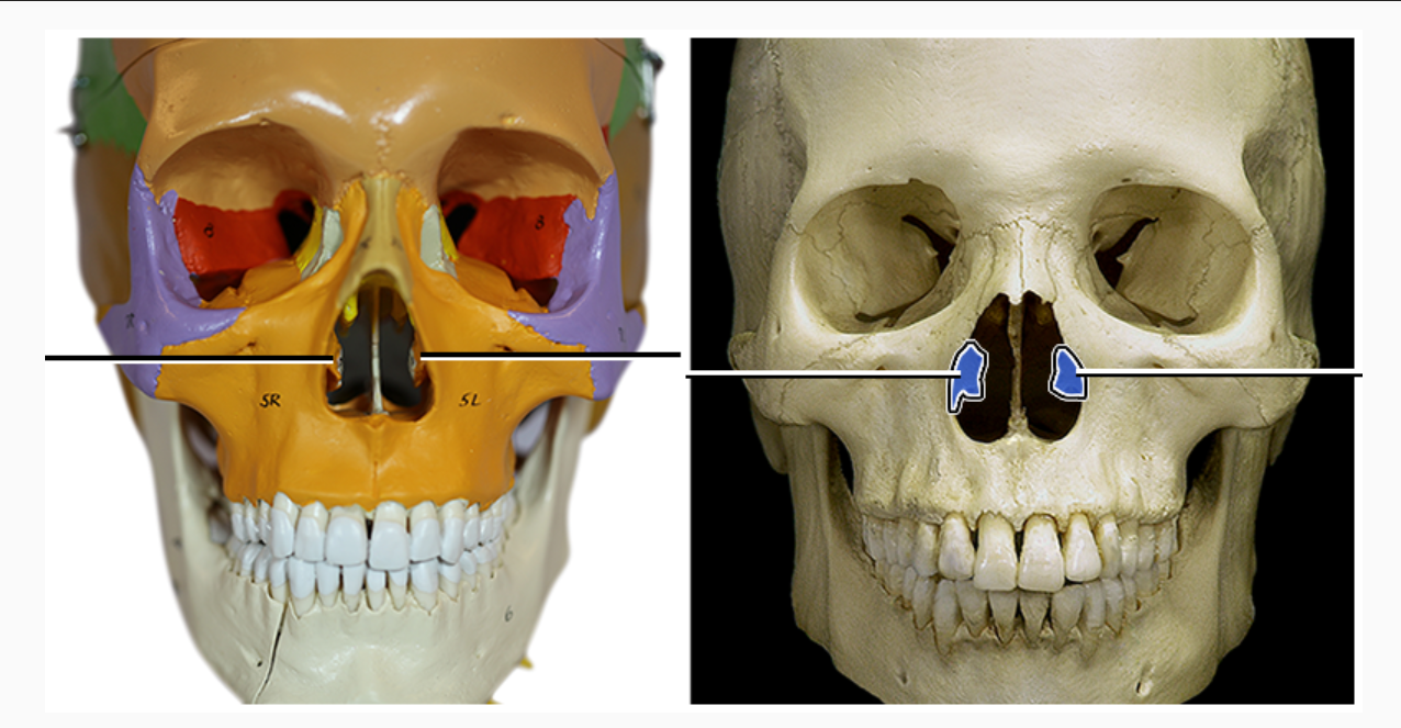 <p>What structure is indicated</p>