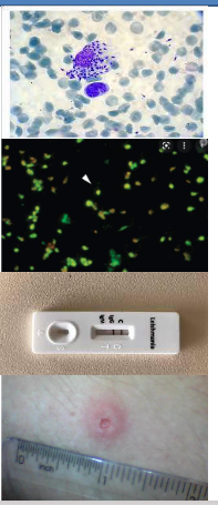 <p>Diagnosis of Visceral Leishmaniasis</p>
