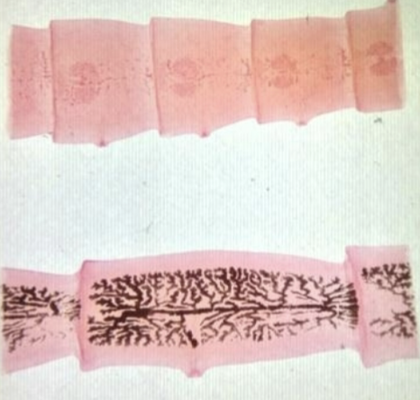 <p>What parasitic worm are these?</p>