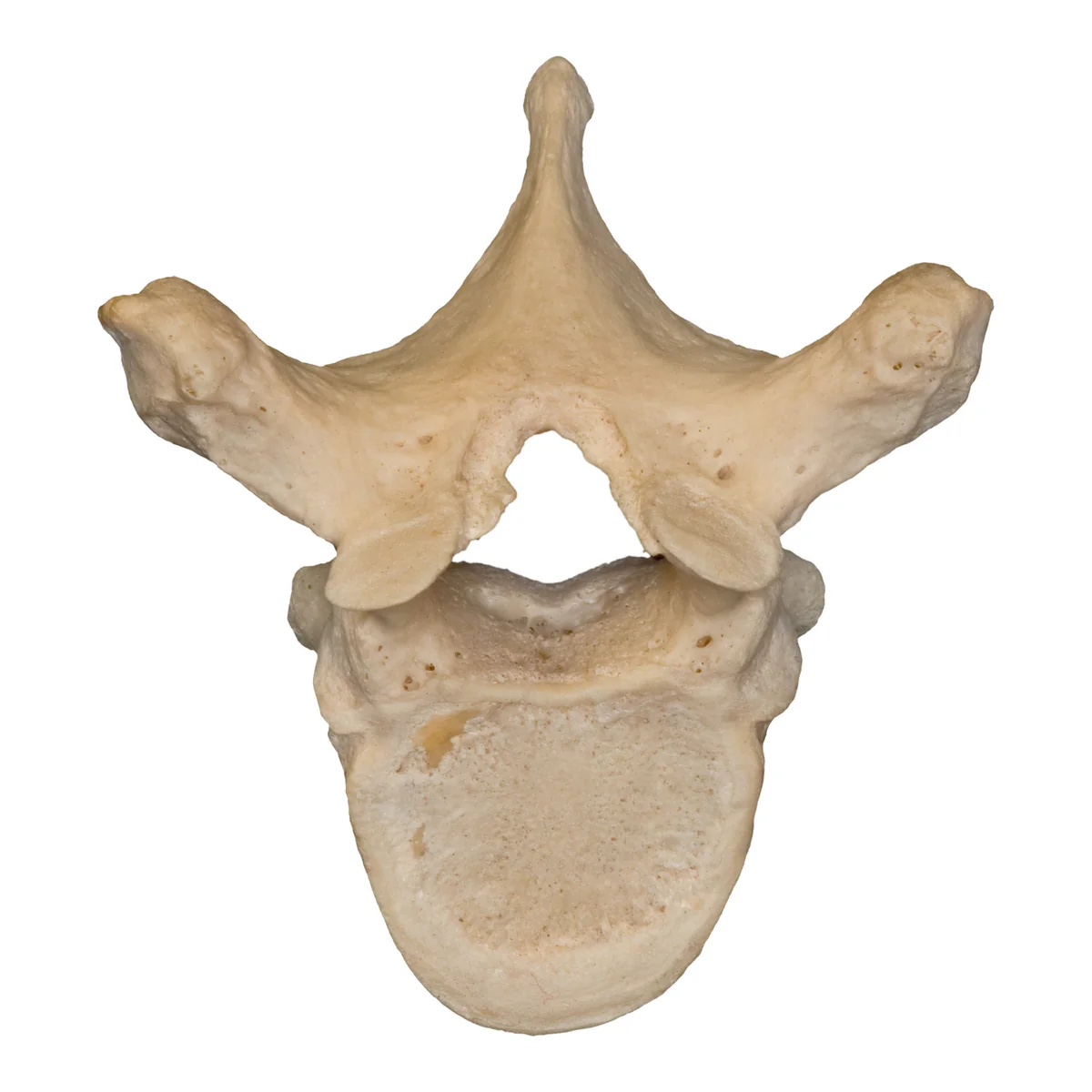 <p>What vertebrae? Identify key process</p>
