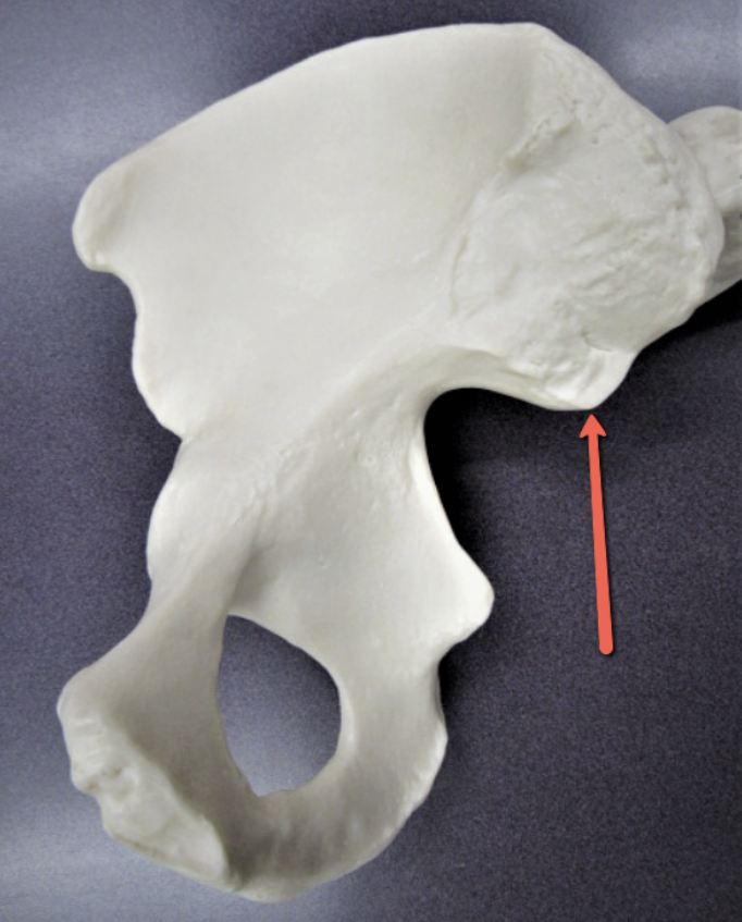 <p><strong>Identify the bone marking indicated by the pointer.</strong></p>