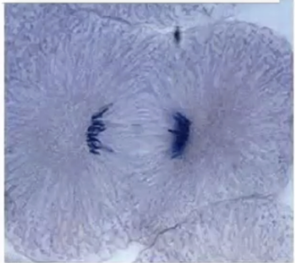 <p><span style="background-color: transparent;">anaphase</span></p>