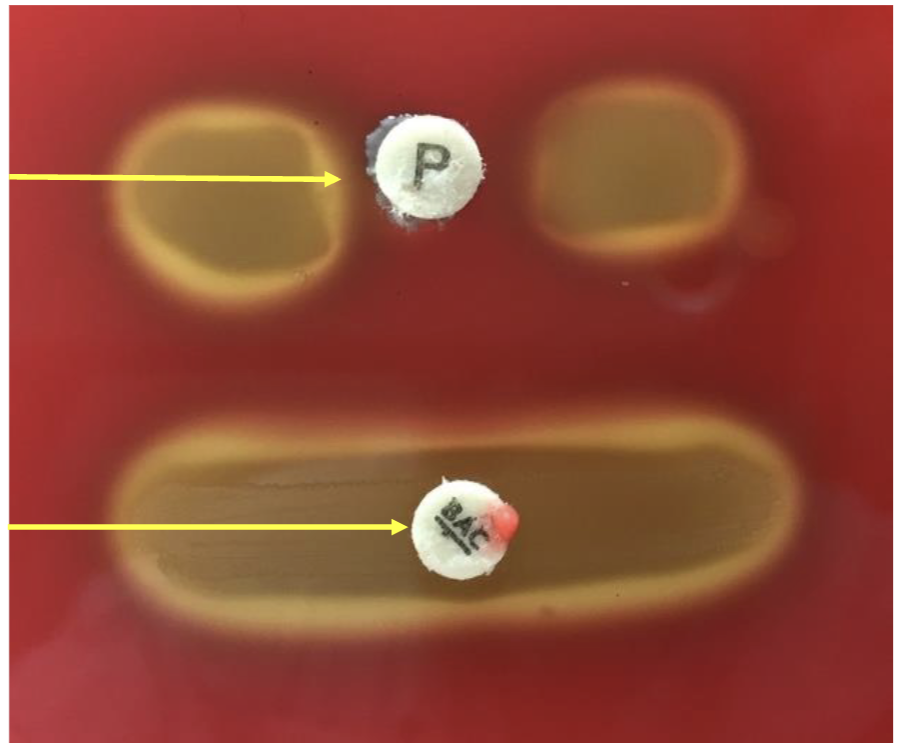 <p>what is the bottom with bac mean?</p>
