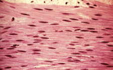 <p>What muscle is this?</p>