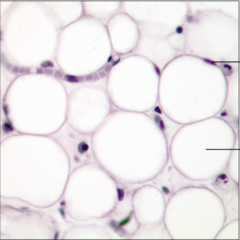 <p>name the tissue: gel-like matrix with all three fibers types but very sparse; closely packed fat cells; nucleus pushed to the side by large fat droplet</p>