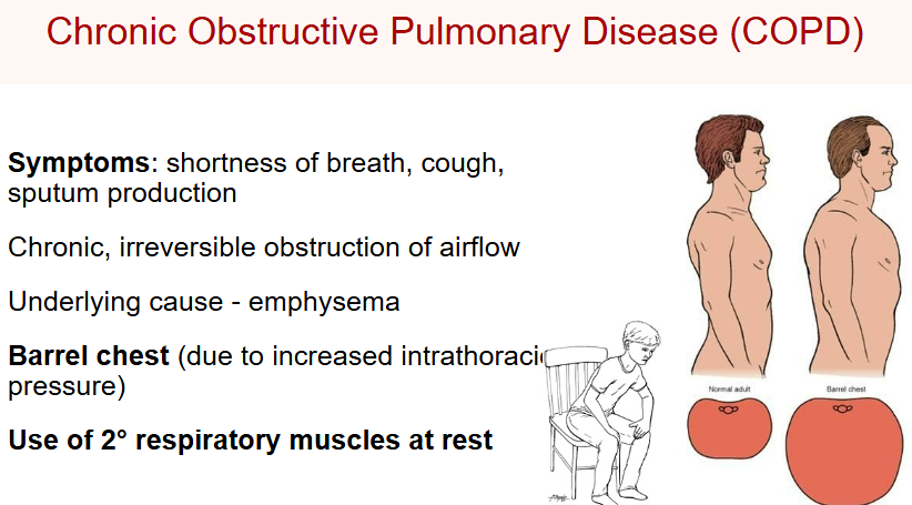 <p>caused by smoking usually<br><br>Damaged alveoli</p><ul><li><p>Difficult expiration</p></li><li><p>Air trapping</p></li><li><p>Barrel chest</p></li><li><p>Accessory muscles used even at rest</p></li></ul><p></p>
