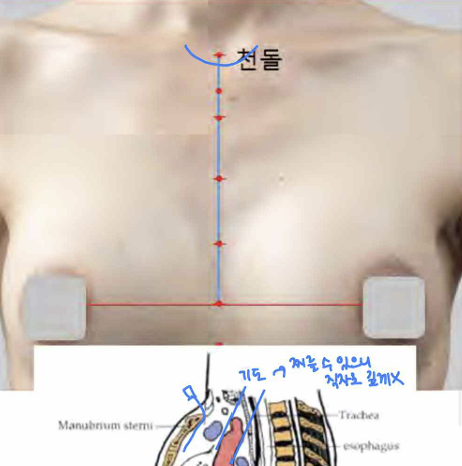 <p>앞정중선 위, 목아래패임 중심</p>