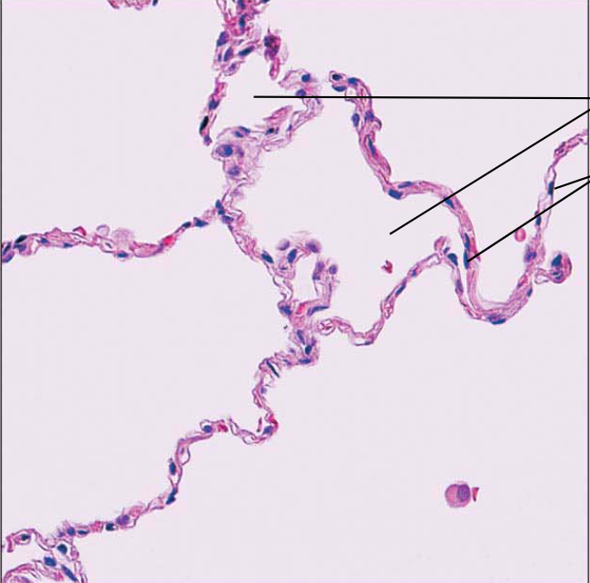 <p>which epithelium tissue is this</p>