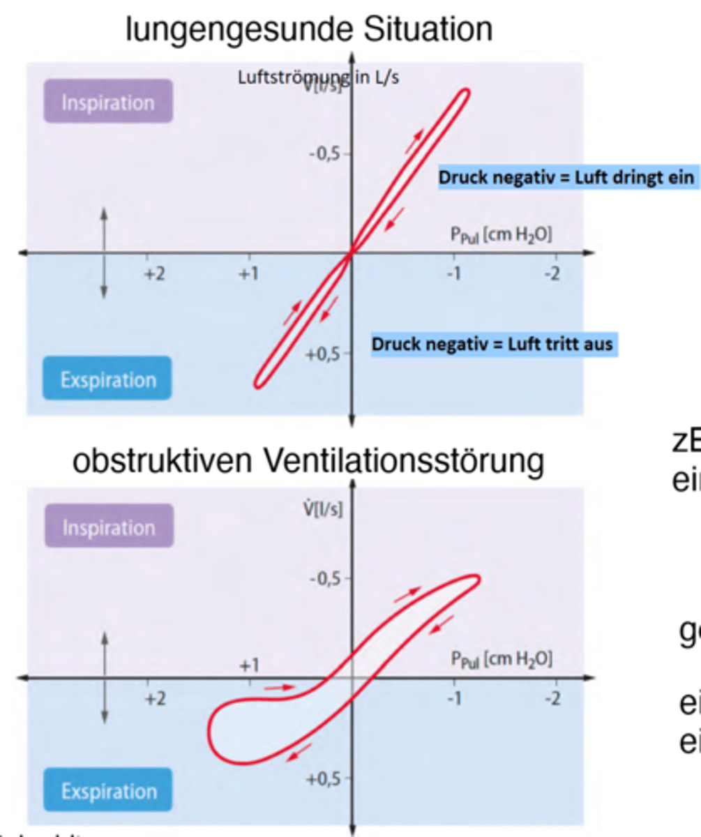 <p>Die Resistance nimmt zu</p><p>-> Zbsp bei einer Schleimansammlung</p><p>=> eine Abflachung der Kurve zeigt eine Zunahme der Resistance -> Bild</p>