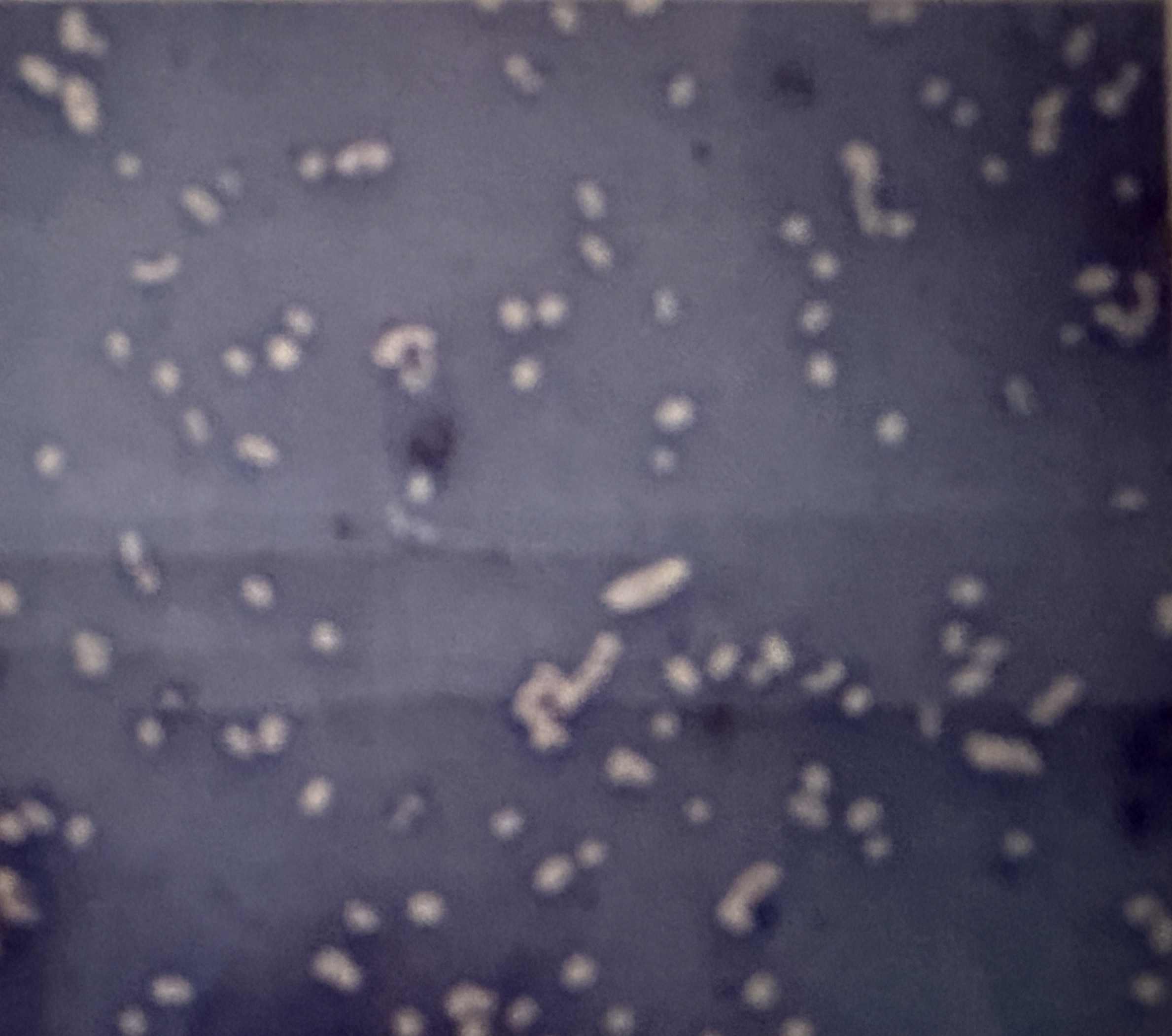 <p>Klebsiella pneumonia</p>