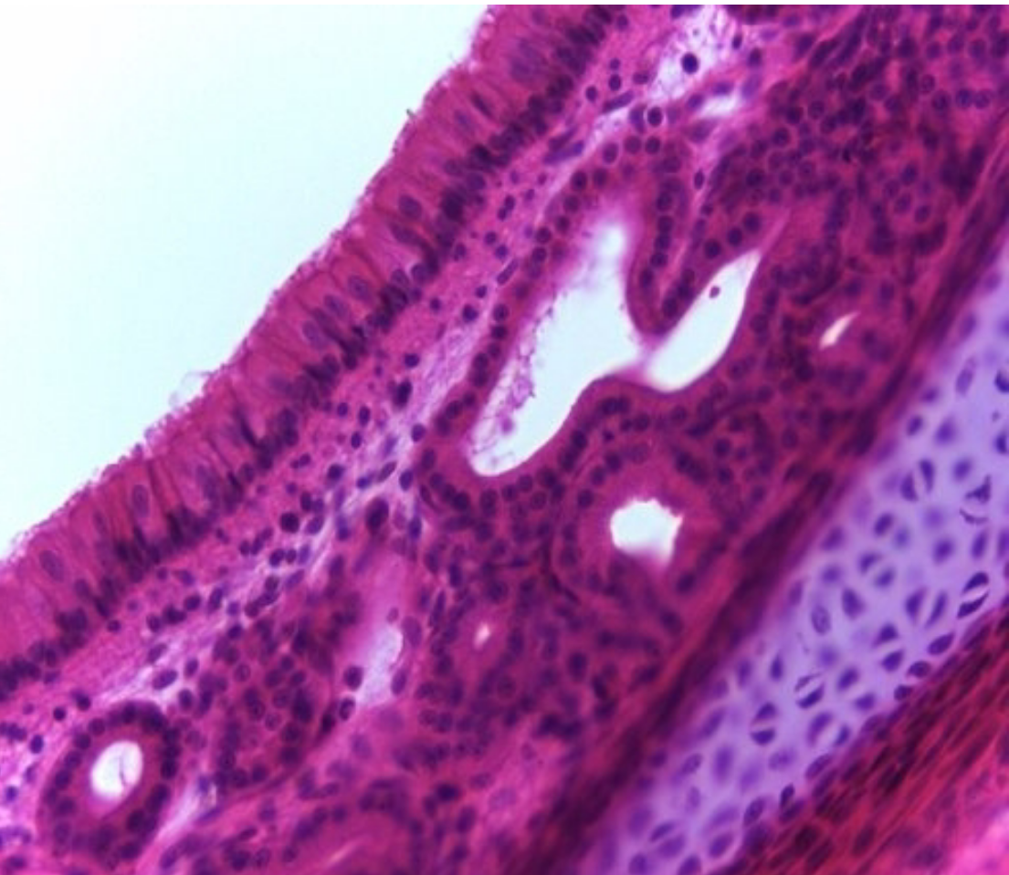 <p>Pseudostratified Columnar Epithelium Ciliated</p>