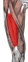<p>Femoral nerve</p>