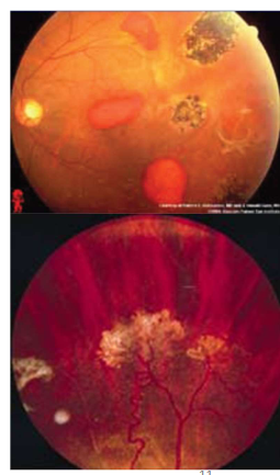 <p>Name the condition</p>