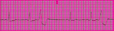 <p>Which rhythm is this?</p>
