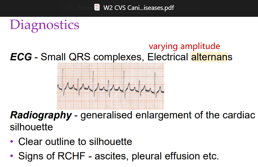 <p>What is the significance of electrical alternans in ECG?</p>