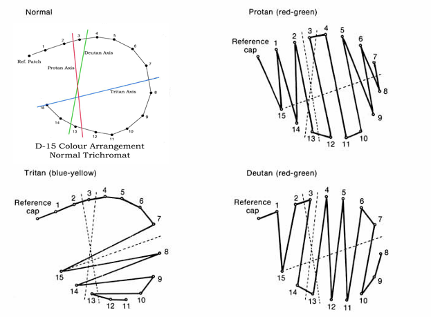 <ul><li><p>hue discrimination </p></li></ul><ul><li><p>Principle: patients will place <strong>colours lying on confusion loci </strong>are placed next to each other.</p></li><li><p>order of colours as arranged by the patient is recorded on a circular diagram </p></li></ul><p>Fail:</p><ul><li><p>generally <strong>2 or more diametrical crossings </strong></p></li></ul><p>Not significant:</p><ul><li><p>minor transposition error</p></li><li><p>especially around colour 7</p></li></ul><p></p>