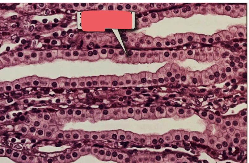 <p>tubules in kidney </p>