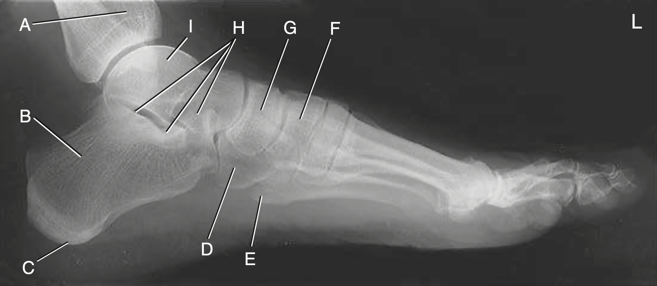 <p>A</p>