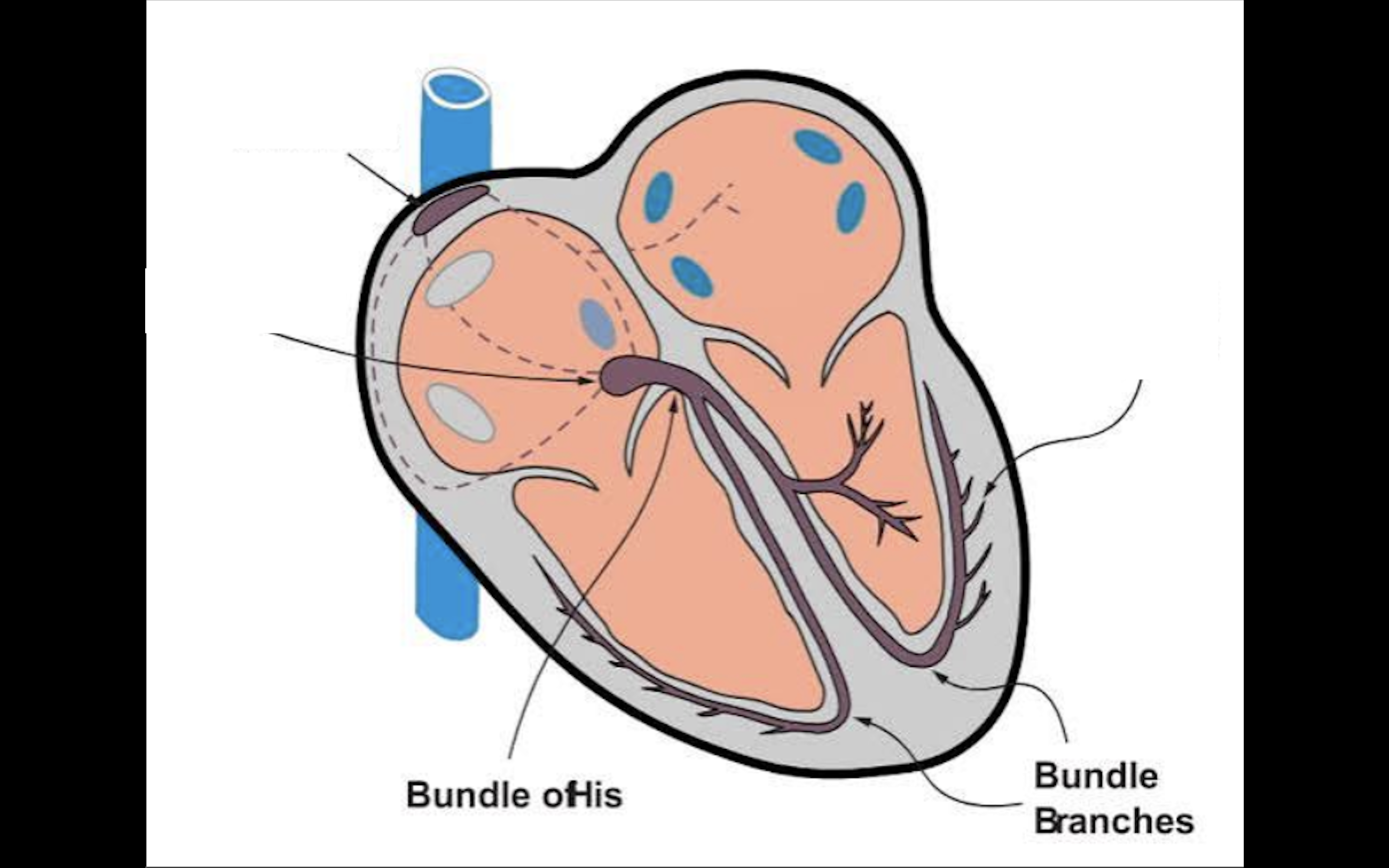 <ul><li><p>Between ventricles</p></li><li><p>Right and left bundle branches</p></li><li><p>Sends impulse to Purkinje fibers</p></li></ul><p></p>