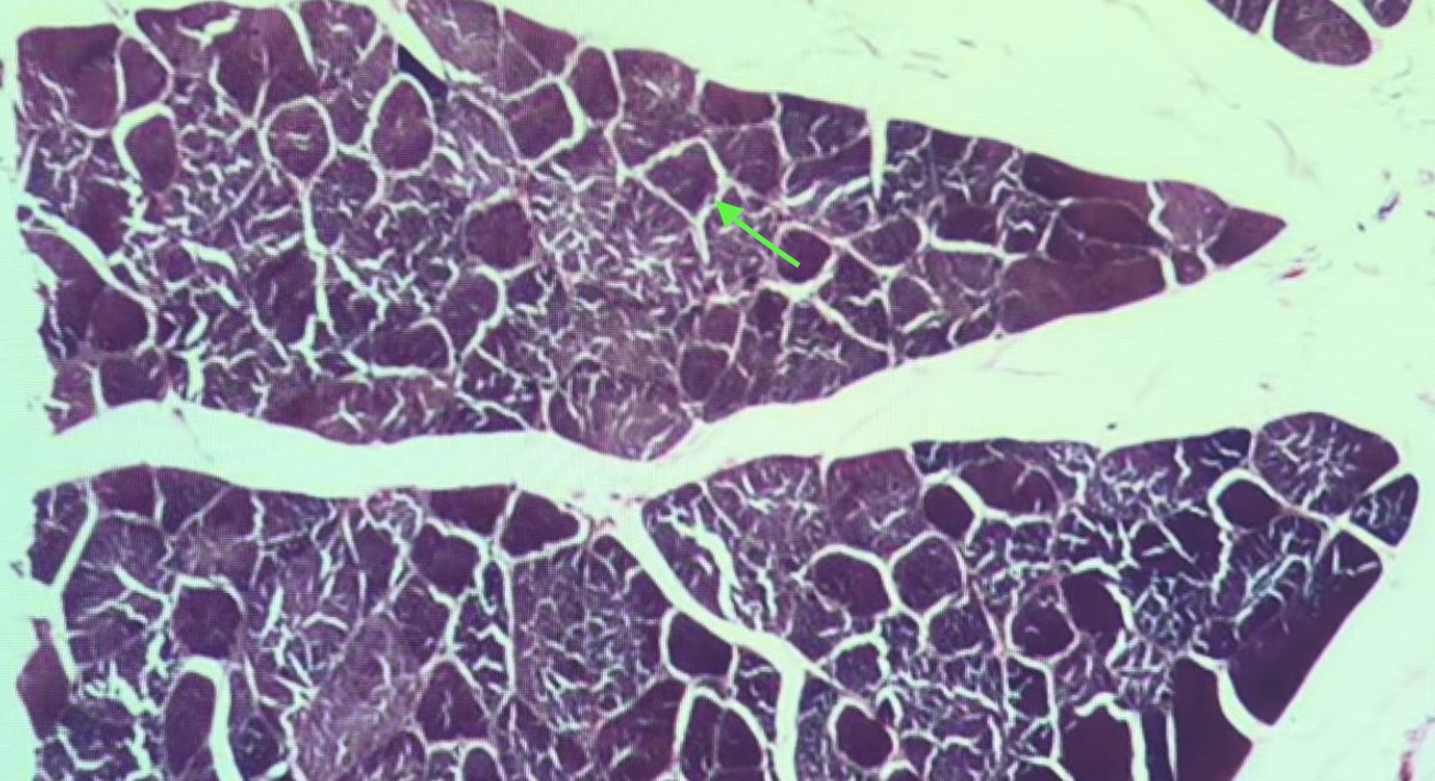 <p>Surrounds individual muscle fiber</p>
