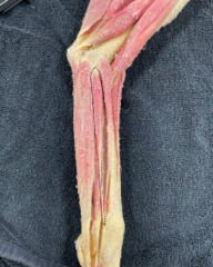 <p>Identify the muscle</p>