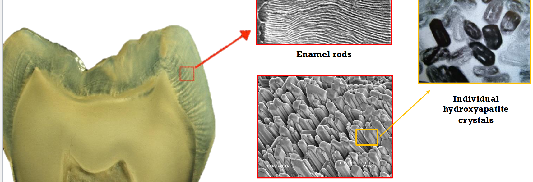 <p>An enamel rod is the basic unit of tooth enamel. It is a tightly packed, highly organized mass of</p><p>hydroxyapatite crystals, which are hexagonal in shape and provide rigidity and strengthen the enamel.</p>