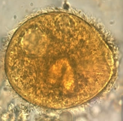 <p>Infrequently seen</p><p>Large, up to 200 microns</p>