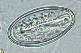 <p>What <strong>type of nematode egg</strong> is this?</p>