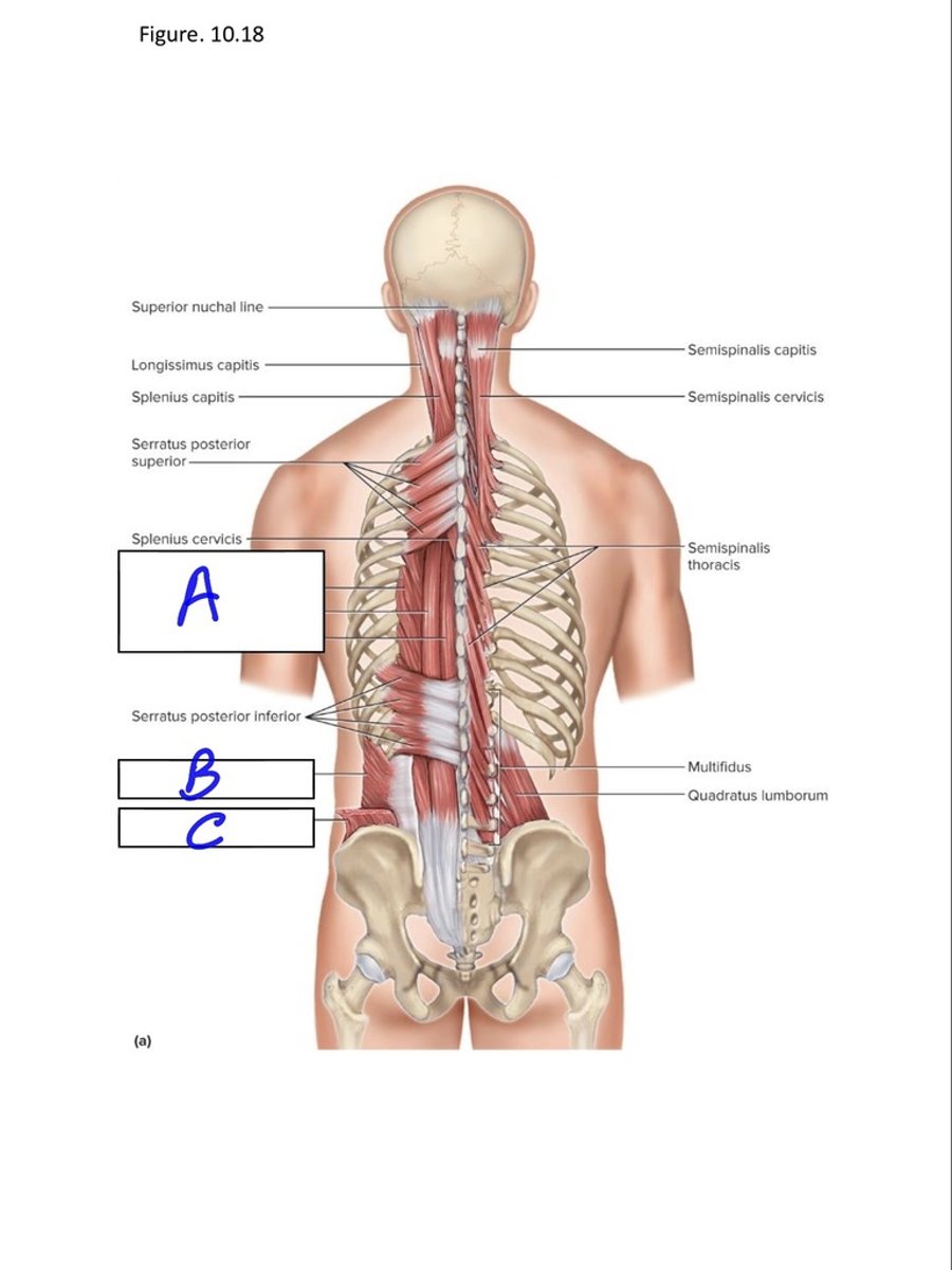 <p>B</p>