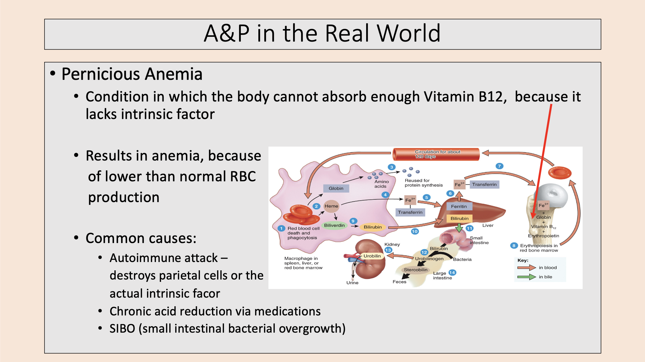 <p><span>pernicious anemia</span></p>