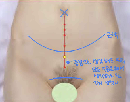 <p>앞정중선 위, 배꼽 중심 아래 4寸</p>