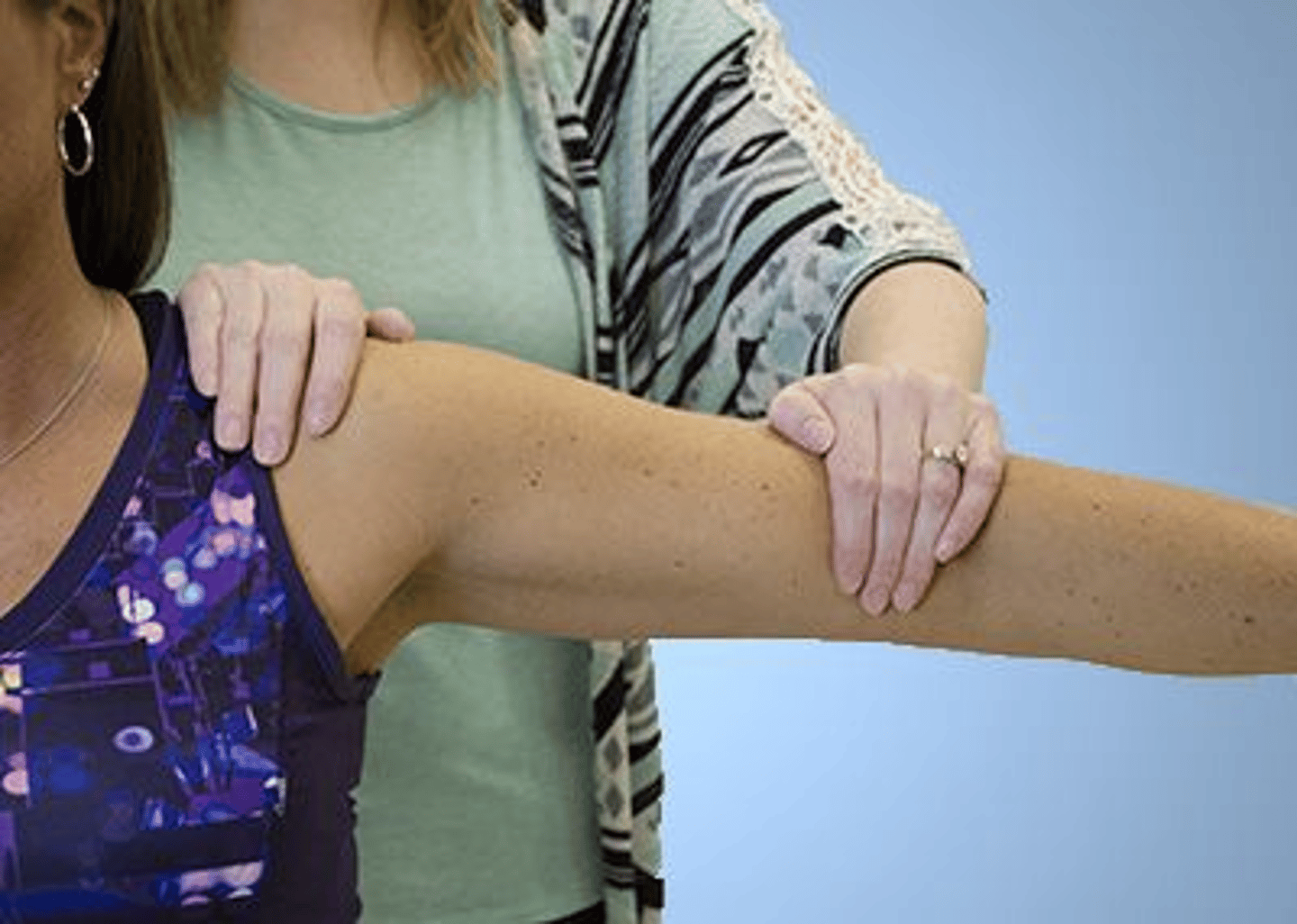<p>3,3</p><p>1. Upright sitting position does not eliminate the effects of gravity. If testing results in a grade below Fair (3/5), gravity should be eliminated.</p><p>2. Sidelying is not a standard testing procedure for the deltoid/supraspinatus. Gravity will still be involved. If testing results in a grade below Fair (3/5), gravity should be eliminated.</p><p>3. Supine position allows the patient to slide the arm on the table. Gravity is eliminated in this position. This is the standard position to test the deltoid/supraspinatus for a grade of Poor (2/5).</p><p>4. Although prone position does minimize gravity, it is not the position of choice for the muscle group being tested.</p>