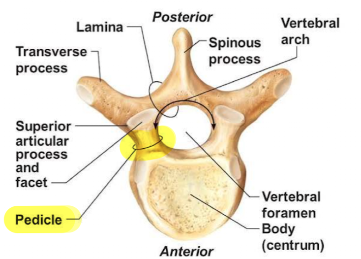 <p><strong>What are pedicles?</strong></p>