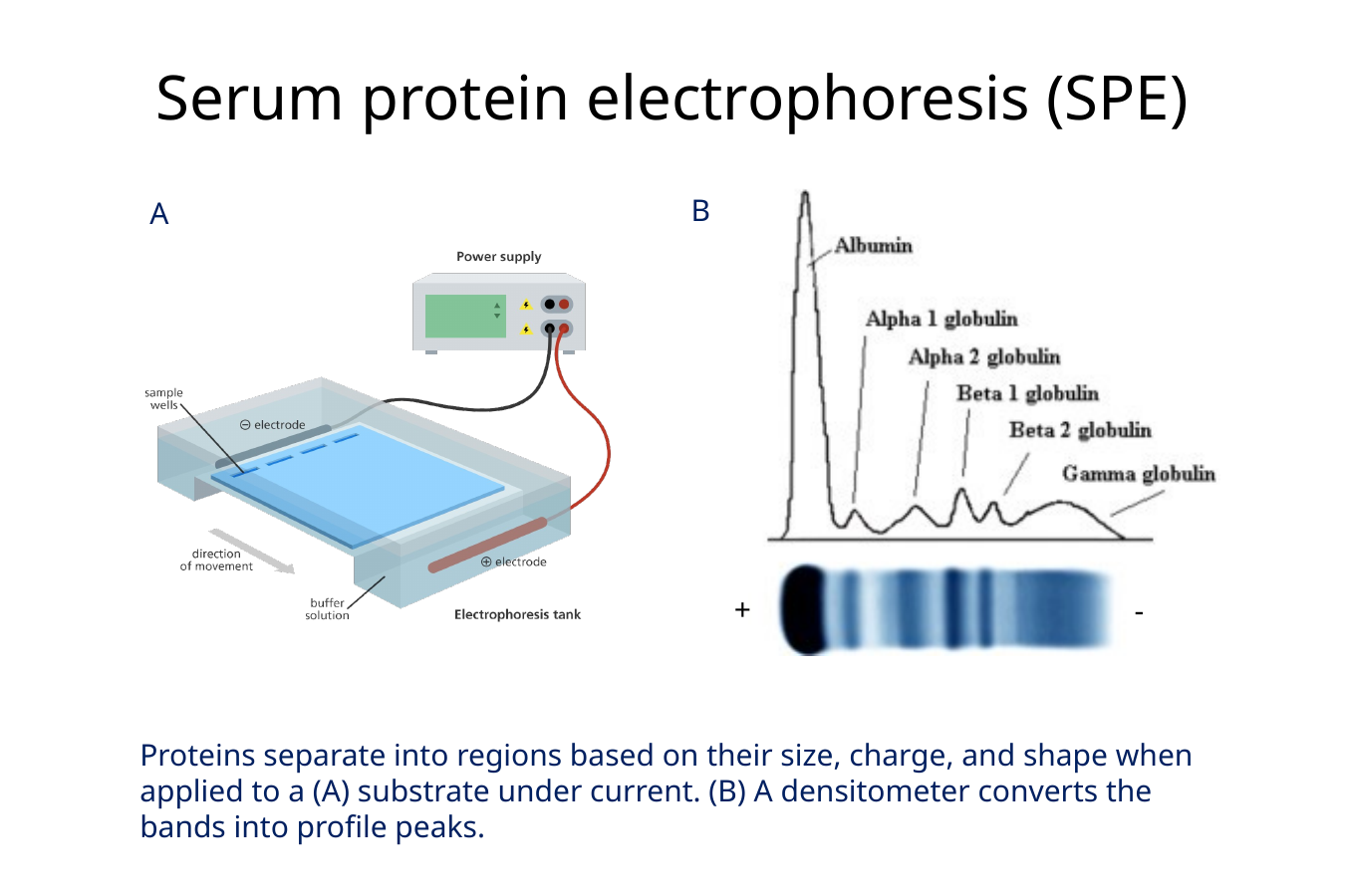 <p><strong>Serum protein electrophoresis separates serum proteins into regions according to their size, charge, and shape, and a densitometer converts the separated bands into profile peaks.</strong></p><p><span data-name="mag_right" data-type="emoji">🔎</span> <strong>What this means:</strong></p><p>The sample is placed on a substrate under an electrical current.</p><p>Different proteins migrate differently, producing distinct protein regions that can then be evaluated for abnormal patterns</p><p><strong>Focus on:</strong> the separated bands becoming the peaks on the right.</p>