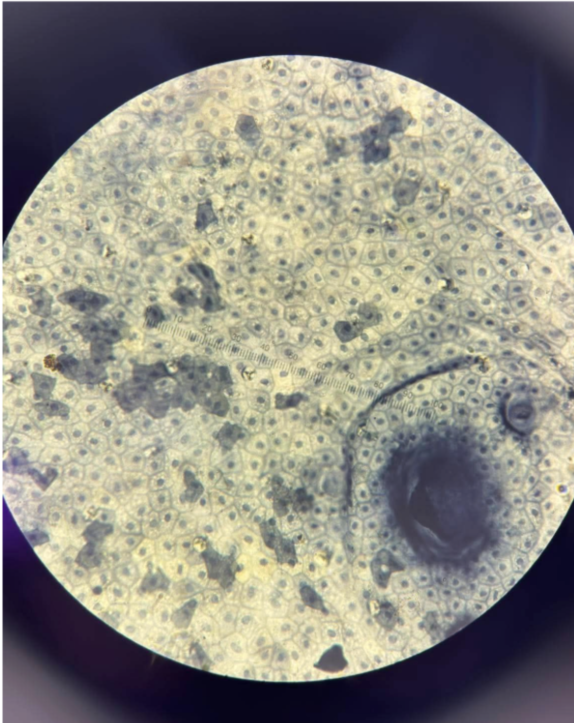 <p><span style="background-color: transparent;">simple squamous epithelial tissue&nbsp;</span></p>