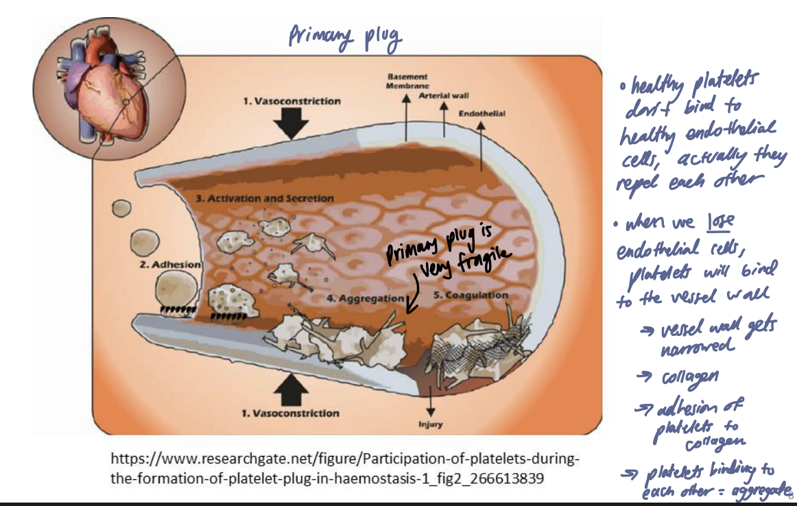 <p><strong>Primary hemostasis proceeds through platelet adhesion, platelet activation and recruitment, and platelet aggregation to form the primary hemostatic plug.</strong></p><p><span data-name="mag_right" data-type="emoji">🔎</span> <strong>What this means:</strong></p><ol><li><p><strong>Adhesion:</strong> platelets are captured at the injured wall.</p></li><li><p><strong>Activation:</strong> platelets change shape and recruit others.</p></li><li><p><strong>Aggregation:</strong> platelets bind one another through fibrinogen.</p></li></ol><p></p>