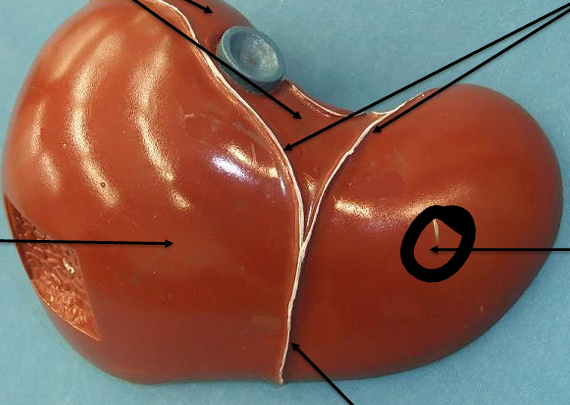 <p>what is this lobe</p>