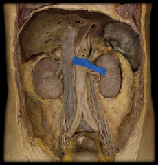 <p>Identify the structure</p>
