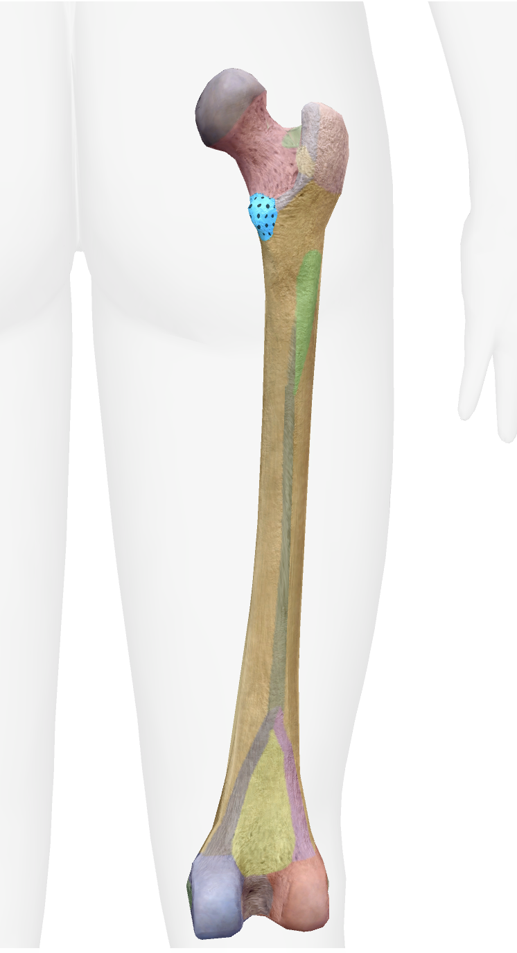 <p>What is this part of the femur </p>