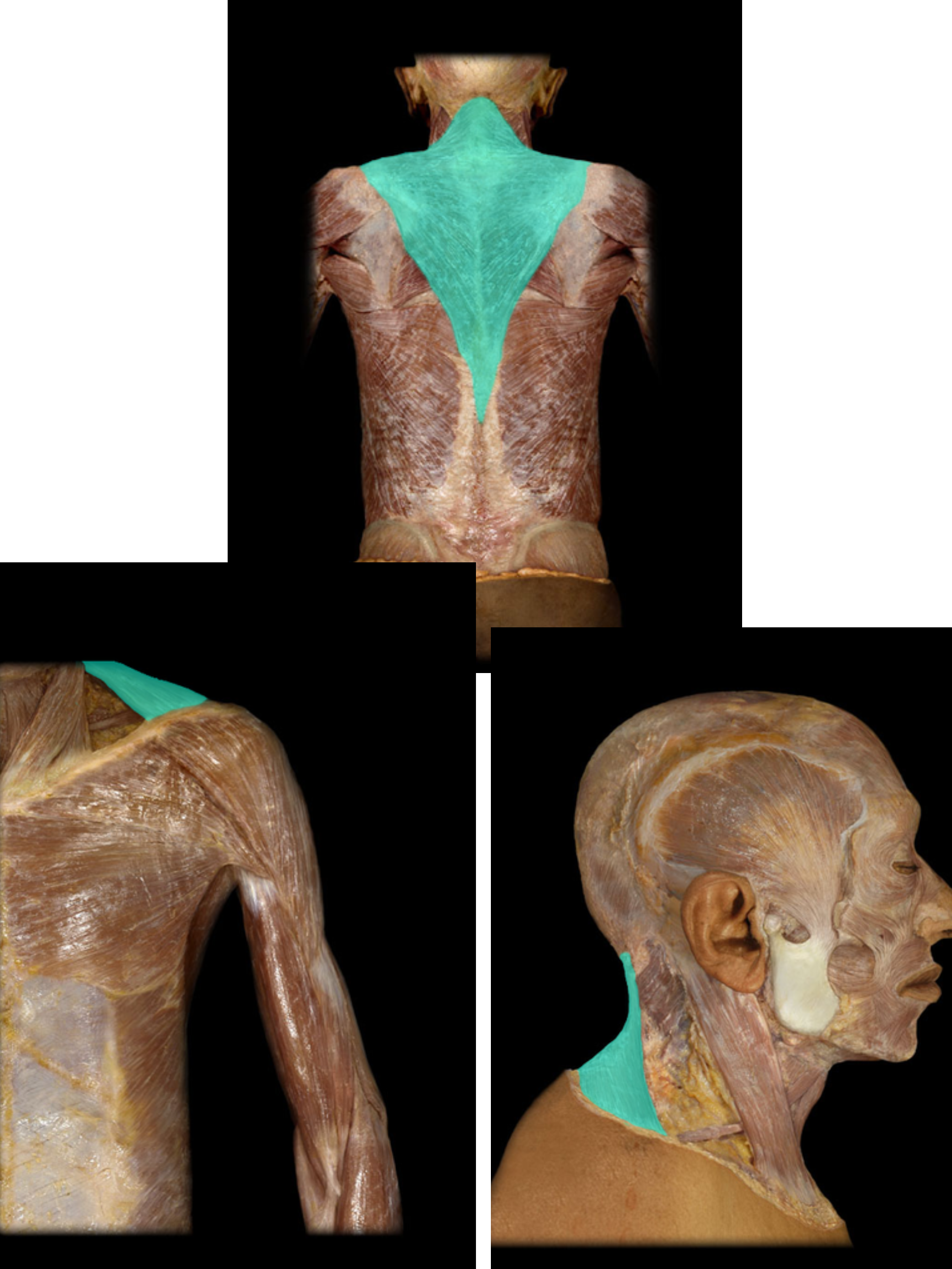<p>Trapezius m.</p>