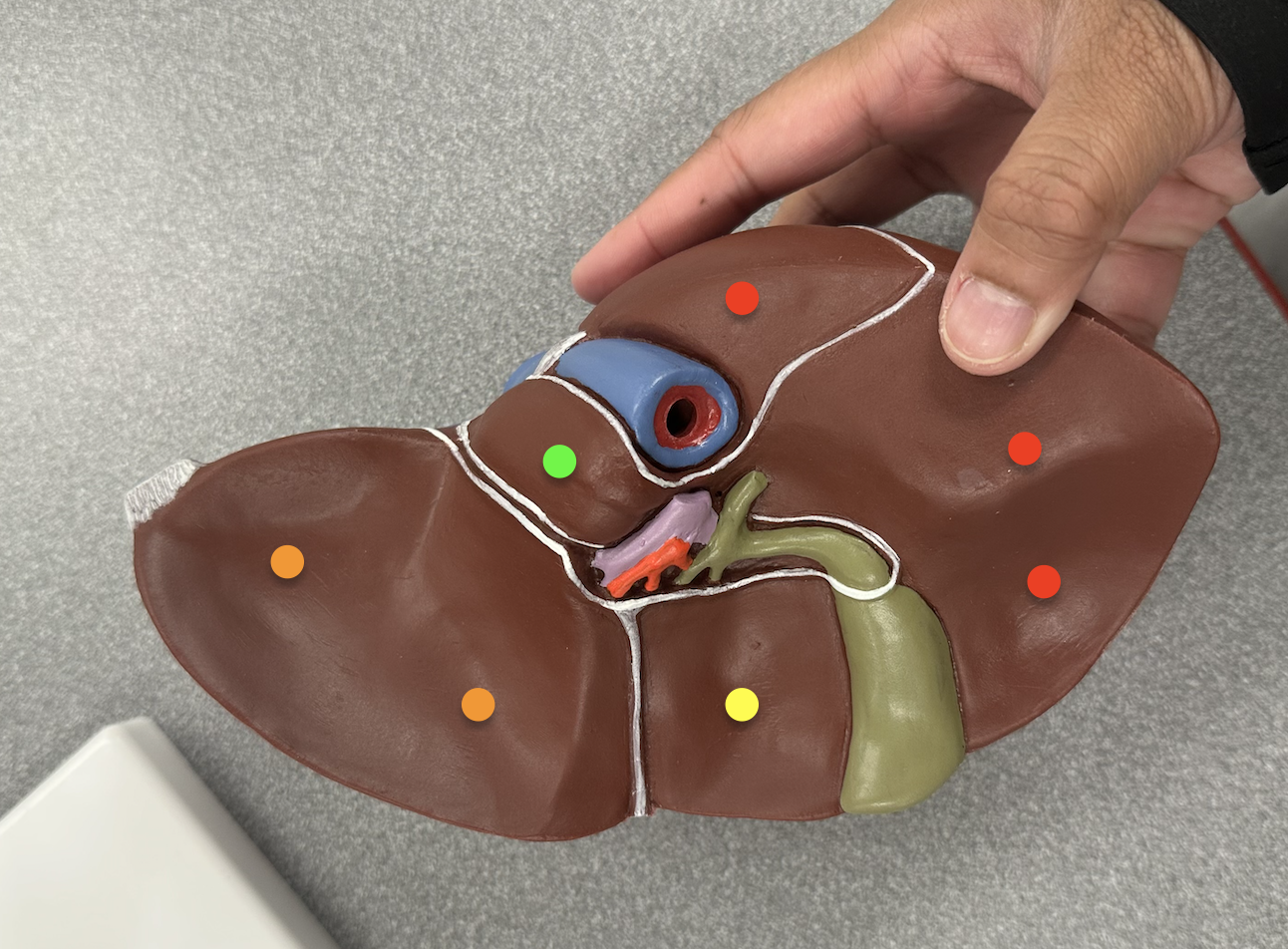 <p>Identify structures / lobes </p>